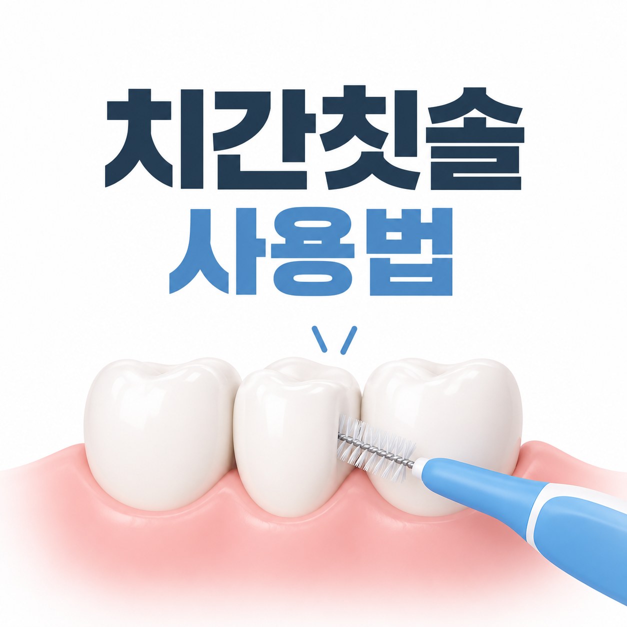 치간칫솔