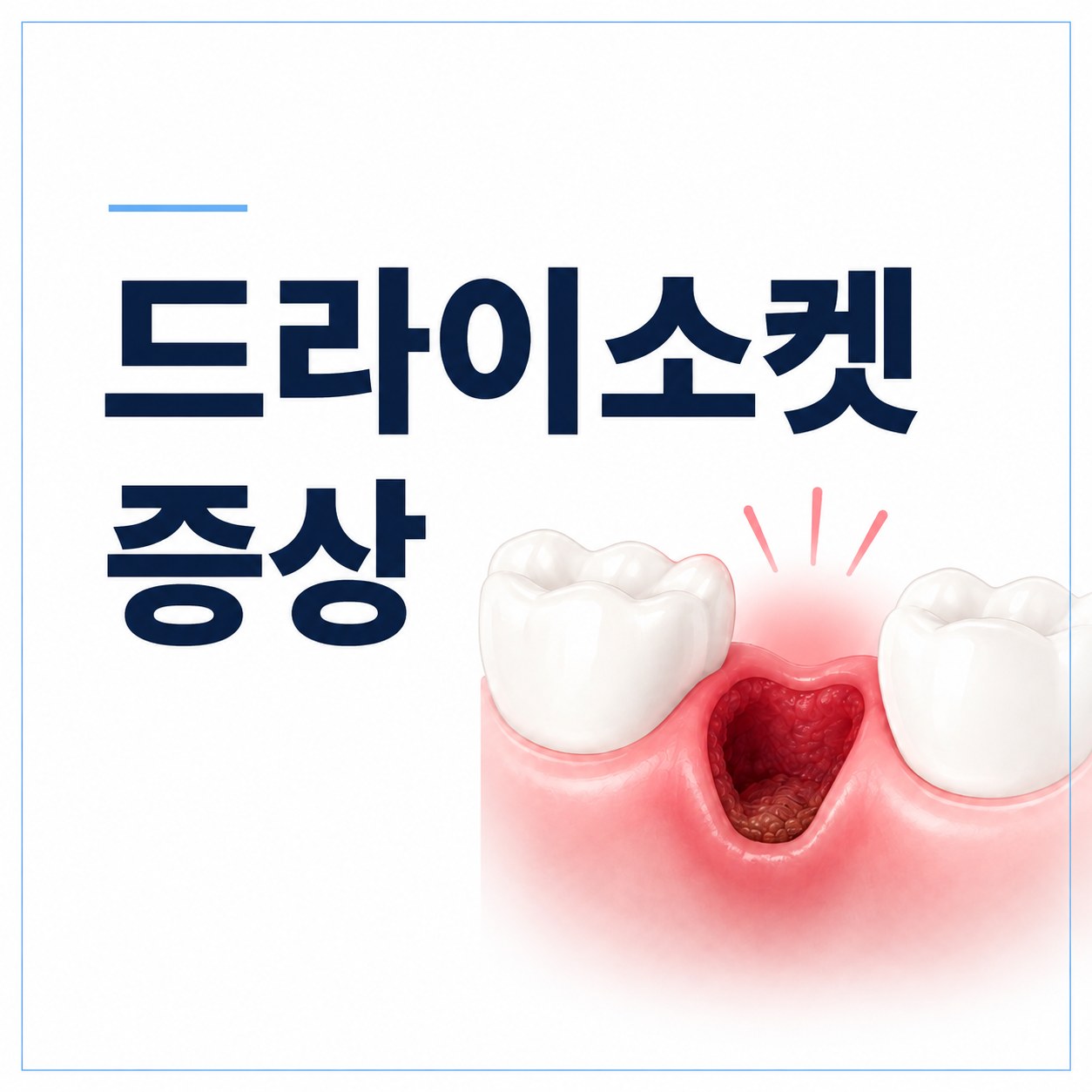 발치 자리